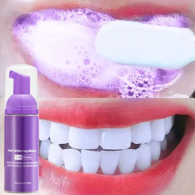 Obtenez des dents éclatantes en seulement trois jours avec notre produit révolutionnaire. Conçu pour s