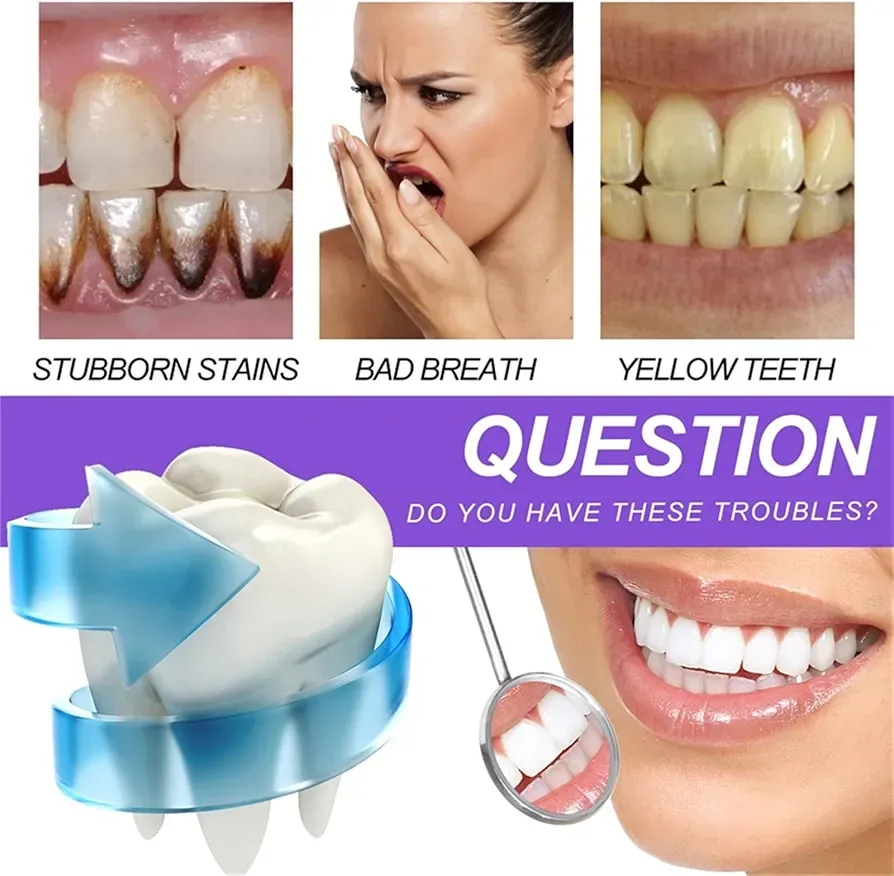 Blanchiment dentaire v34 colour corrector