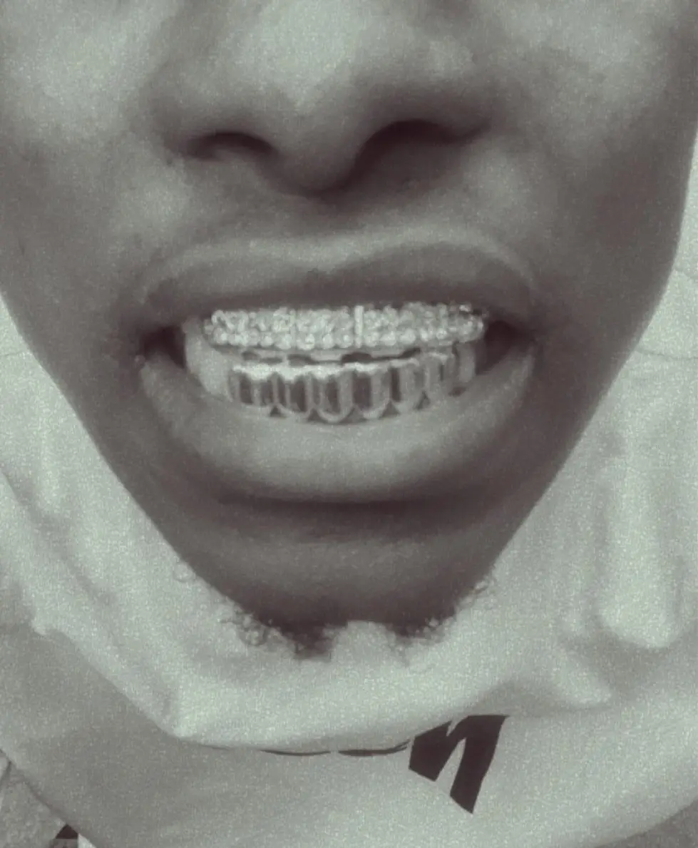 Vue alternative 4 - Dents bling bling style  Rappeur
