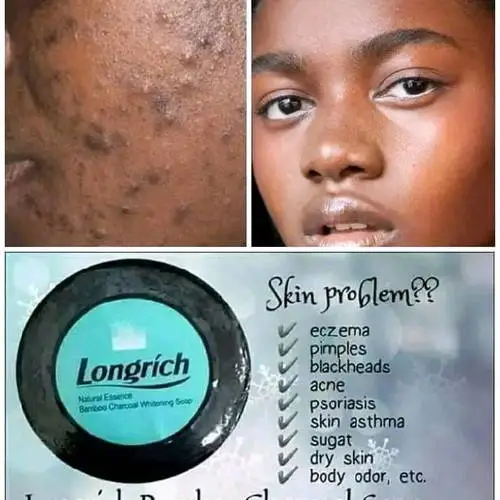 Vue alternative 1 - Savon noir de Longrich anti boutons et tache noir 
