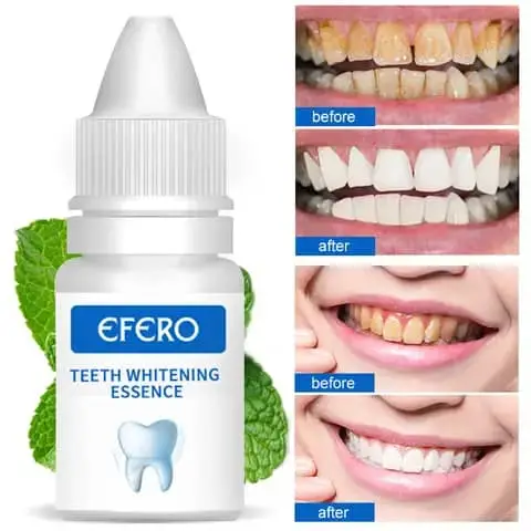 Vue alternative 1 - Prix : 8000F/✨ Obtenez un sourire éclatant avec EFERO Teeth Whitening Essence ! ✨  Vous rêvez de dents blanches et lumineuses ? Grâce à sa formule puissante, EFERO élimine les taches tenaces et ravive la blancheur naturelle de vos dents en quelques applic