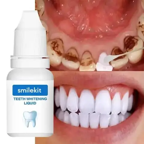 Vue alternative 2 - Prix : 8000F/✨ Obtenez un sourire éclatant avec EFERO Teeth Whitening Essence ! ✨  Vous rêvez de dents blanches et lumineuses ? Grâce à sa formule puissante, EFERO élimine les taches tenaces et ravive la blancheur naturelle de vos dents en quelques applic