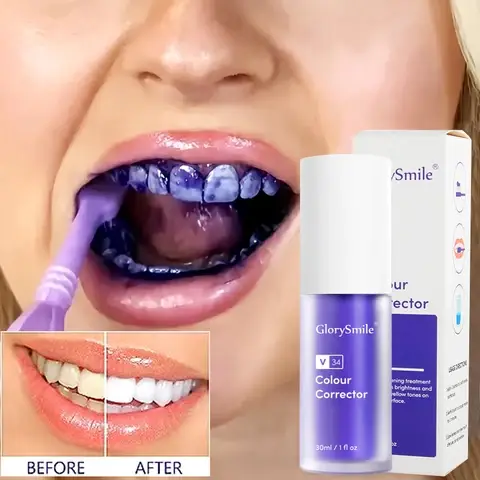 Vue alternative 4 - Blanchiment dentaire v34 colour corrector