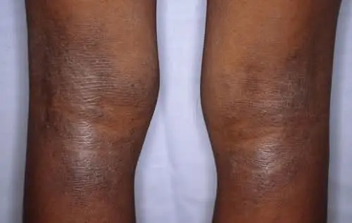 Vue alternative 2 - ?STOP AUX TÂCHES NOIRES – RETROUVEZ UNE PEAU ÉCLATANTE ET UN TEINT UNIFORME !?