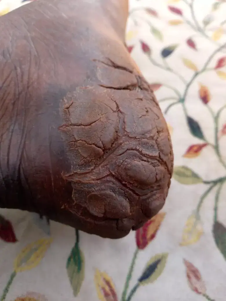 Vue alternative 2 - ?FINI LES TALONS SECS ET NOIRS AVEC CE SAVON 100% NATUREL – LIVRAISON À BAMAKO ?