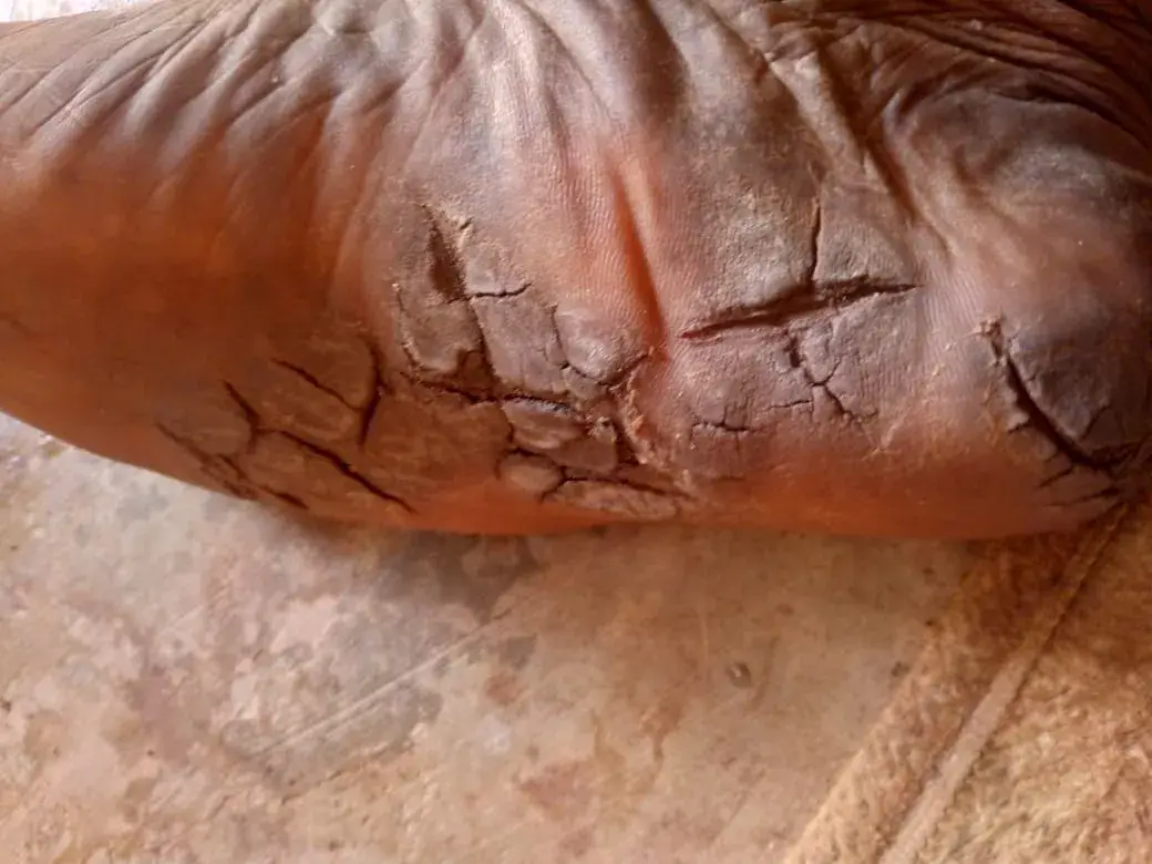 Vue alternative 4 - ?FINI LES TALONS SECS ET NOIRS AVEC CE SAVON 100% NATUREL – LIVRAISON À BAMAKO ?