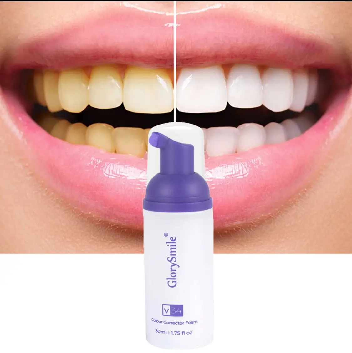 Vue alternative 3 - Glory Smile