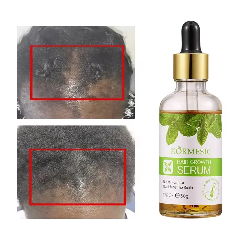 Vue alternative 3 - Pousse cheveux