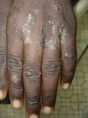 Disponible au MALI - Vue détaillée 3