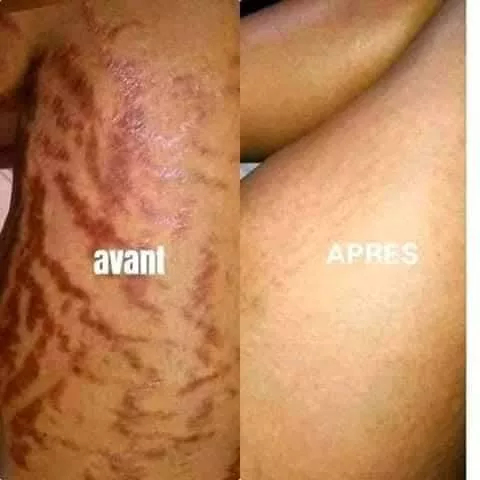 Disponible au MALI - Vue détaillée 7