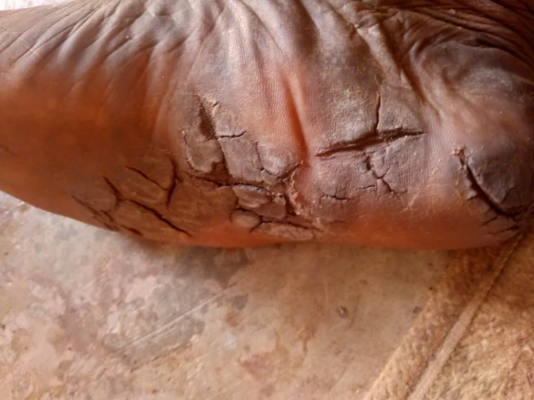 🛑FINI LES TALONS SECS ET NOIRS AVEC CE SAVON 100% NATUREL – LIVRAISON À BAMAKO 🛑 - Vue détaillée 4