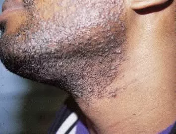 Disponible au MALI - Vue détaillée 8