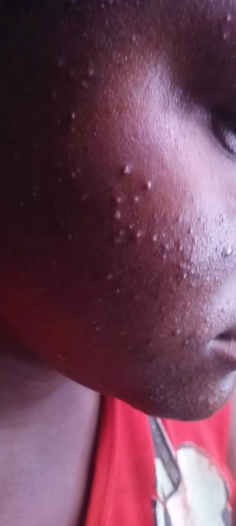 Disponible au MALI - Vue détaillée 1