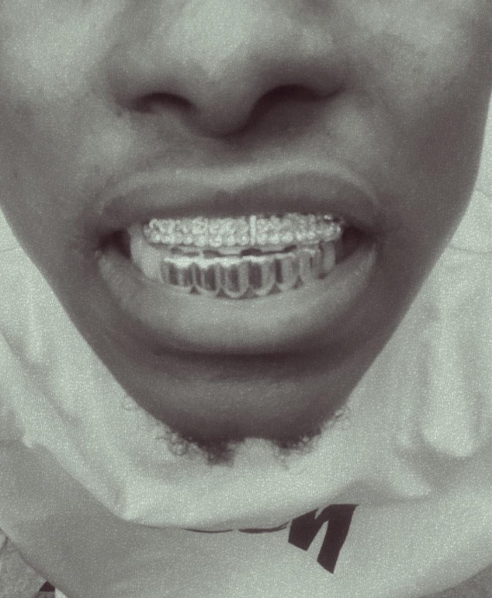 Dents bling bling style  Rappeur - Vue détaillée 4