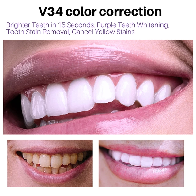 Obtenez des dents éclatantes en seulement trois jours avec notre produit révolutionnaire. Conçu pour s - Vue détaillée 4