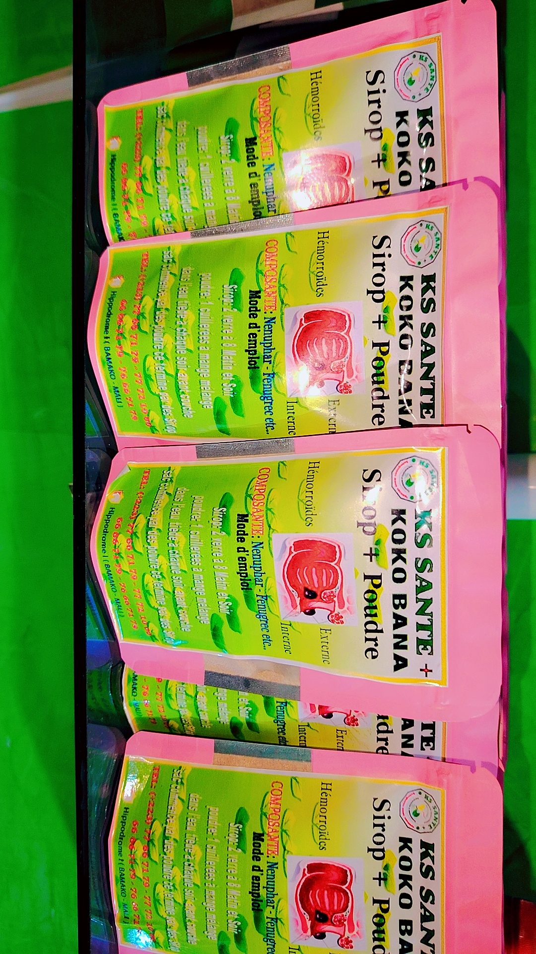 Hémorroïde (koko)  - Vue détaillée 1