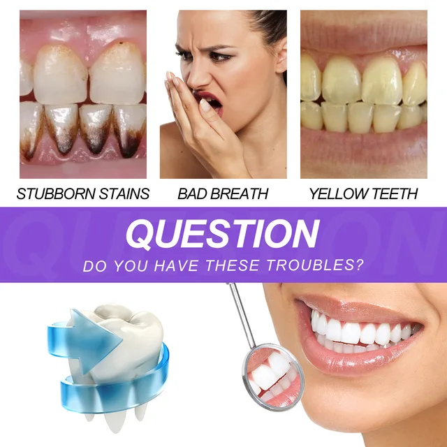 Blancessieur v34  - Vue détaillée 3