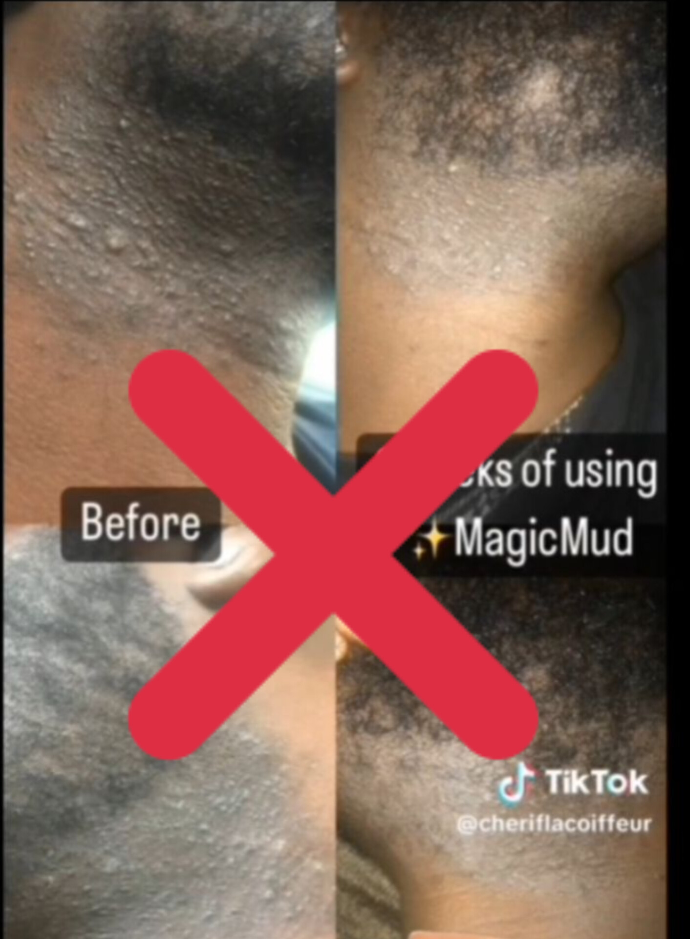 Crème épilatoire enlevé les poils sans rasoirs - Vue détaillée 1