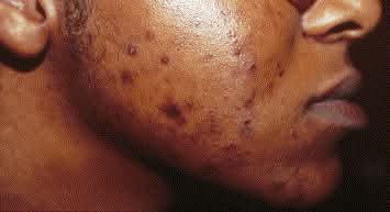 🛑STOP AUX TÂCHES NOIRES – RETROUVEZ UNE PEAU ÉCLATANTE ET UN TEINT UNIFORME !🛑 - Vue détaillée 1