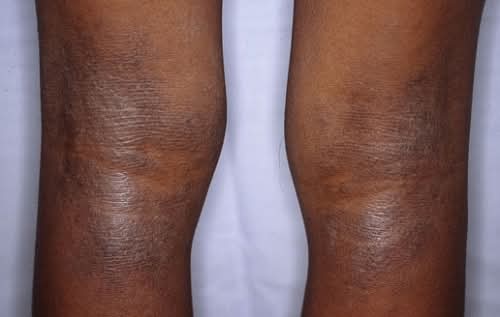 🛑STOP AUX TÂCHES NOIRES – RETROUVEZ UNE PEAU ÉCLATANTE ET UN TEINT UNIFORME !🛑 - Vue détaillée 2