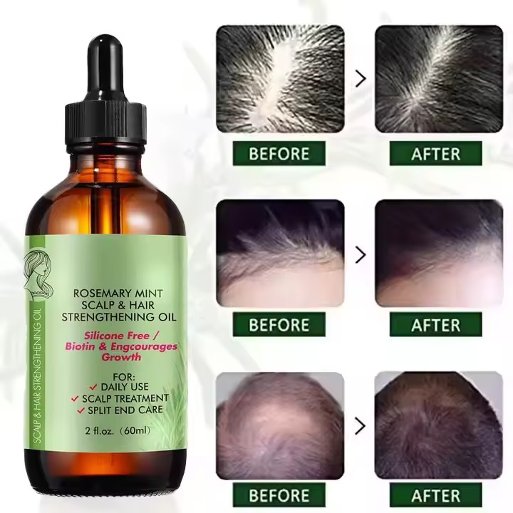 Huile de romarin - Vue détaillée 1