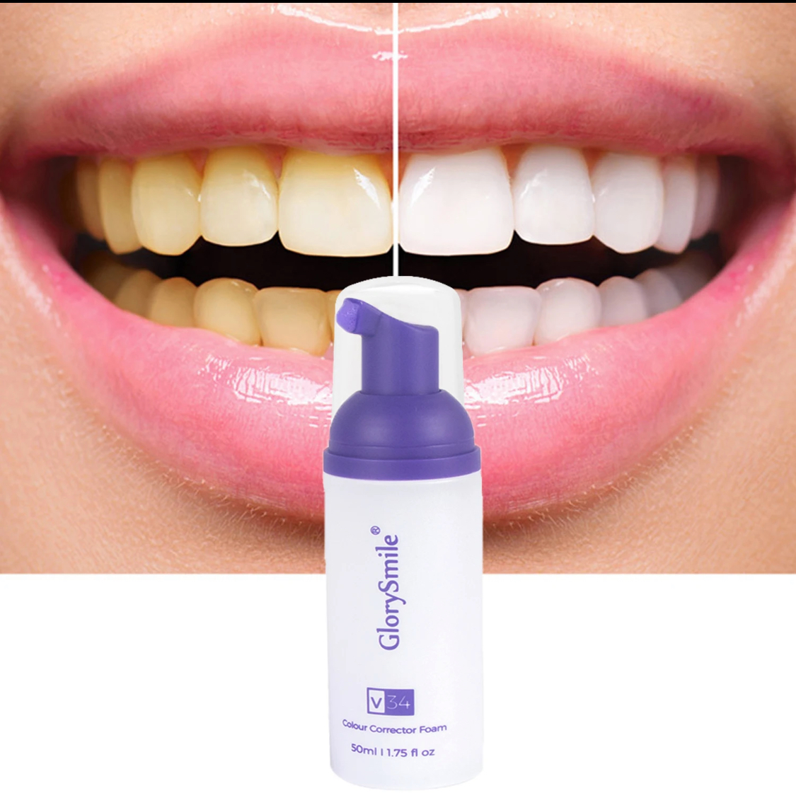 Glory Smile - Vue détaillée 3